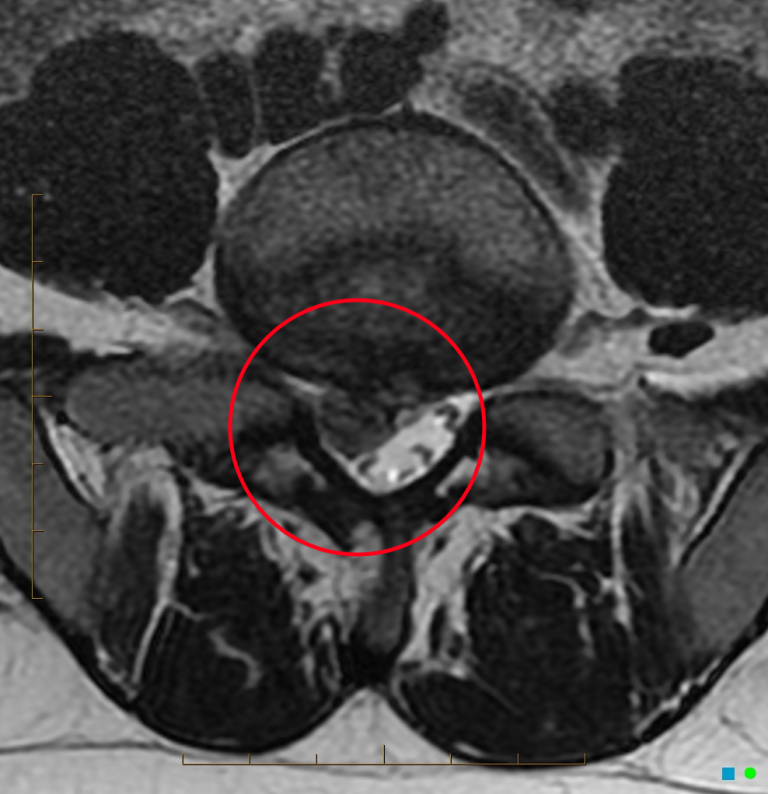 MRTUntersuchung Ein aktueller Guide für Patienten.